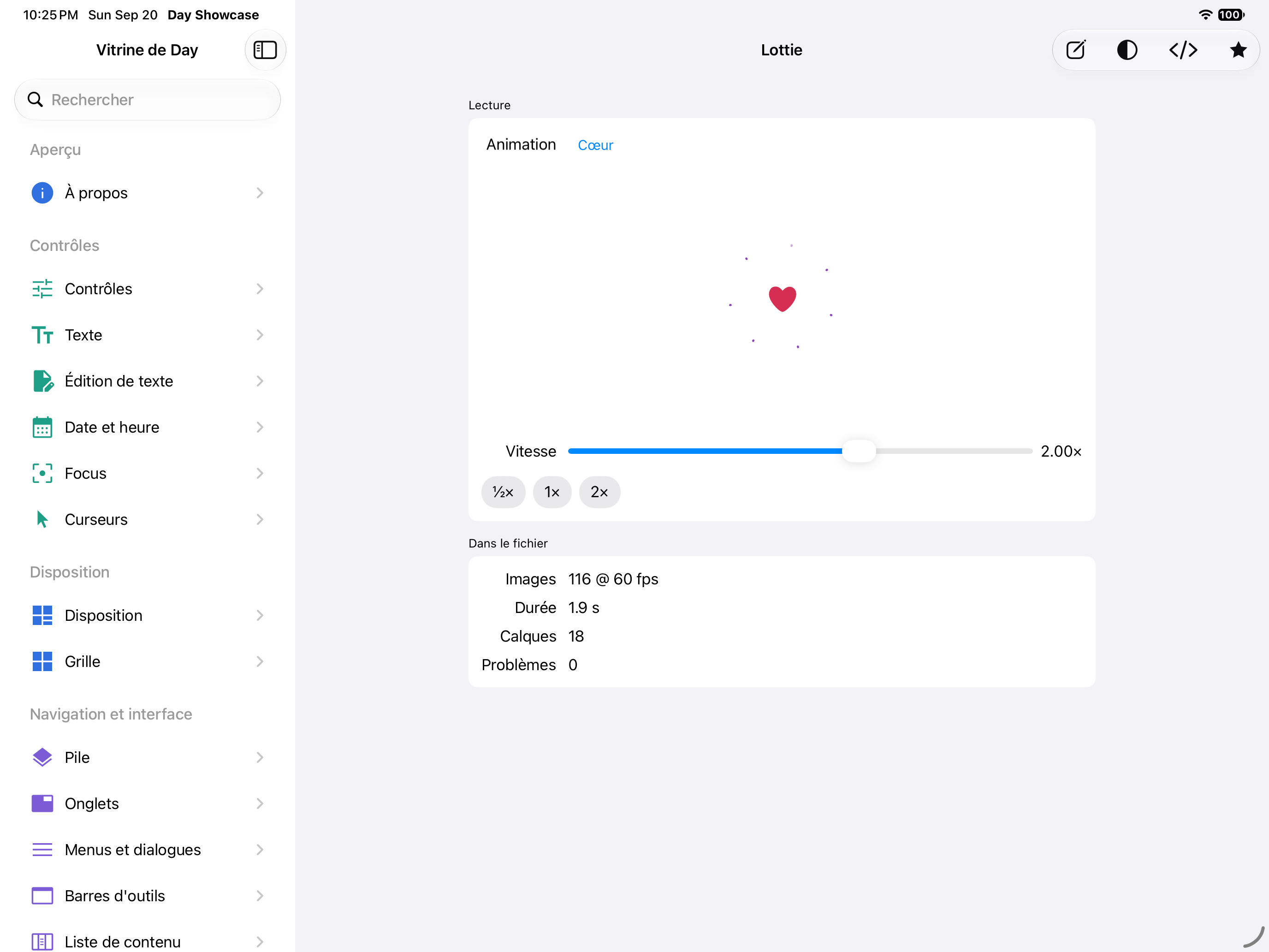 Lottie — iOS (UIKit) · iPad