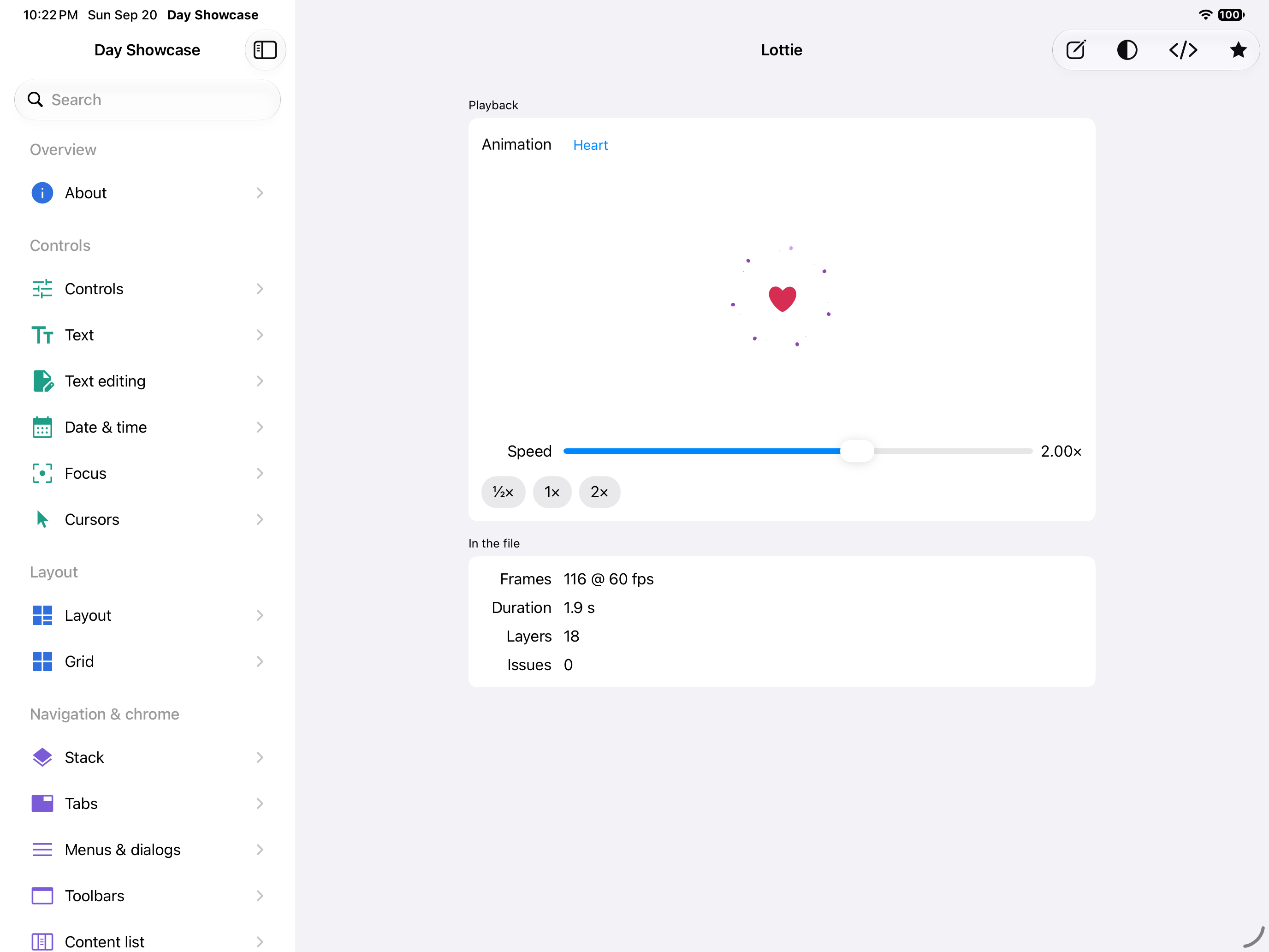 Lottie — iOS (UIKit) · iPad