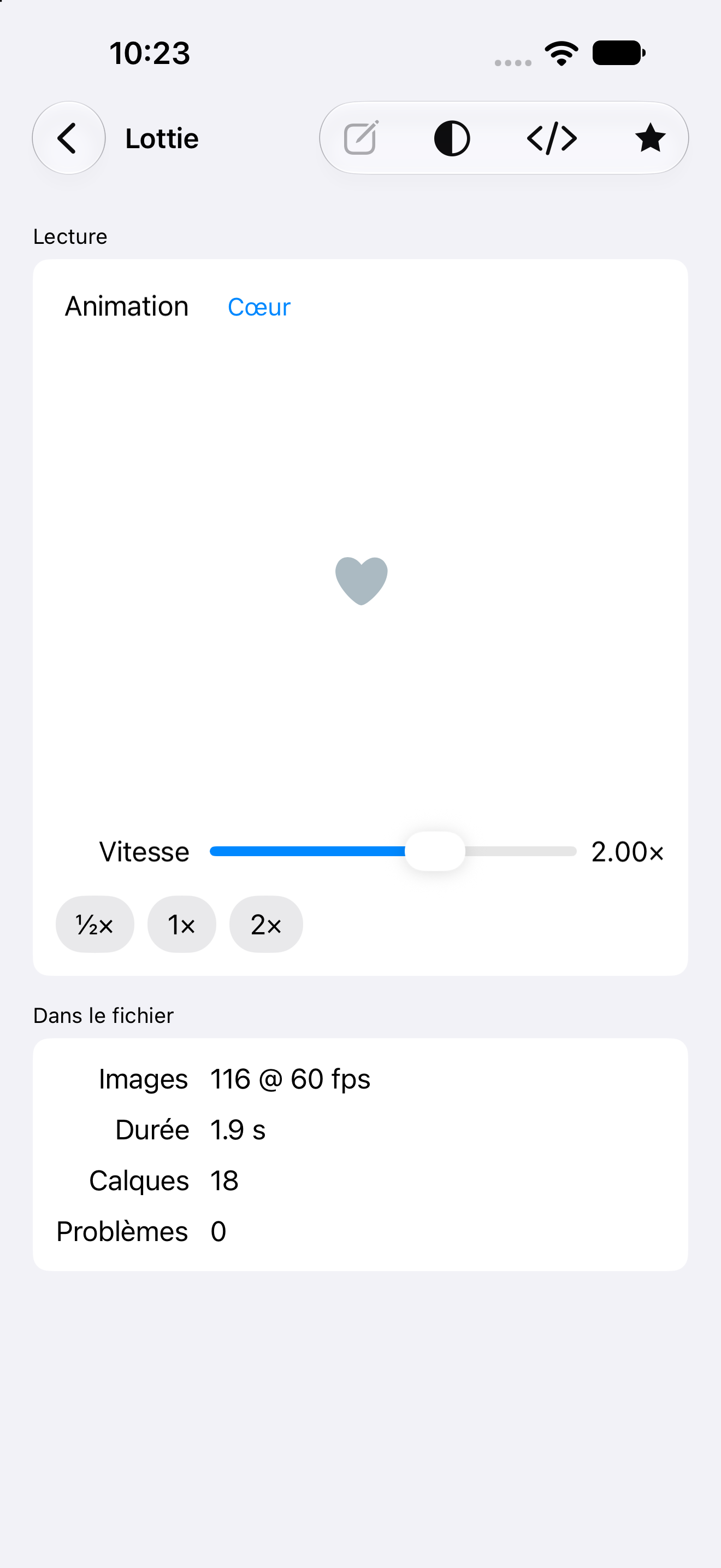 Lottie — iOS (UIKit) · iPhone