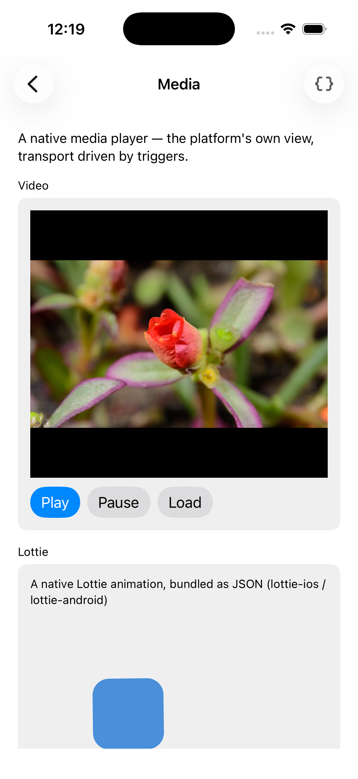Media — iOS (UIKit)