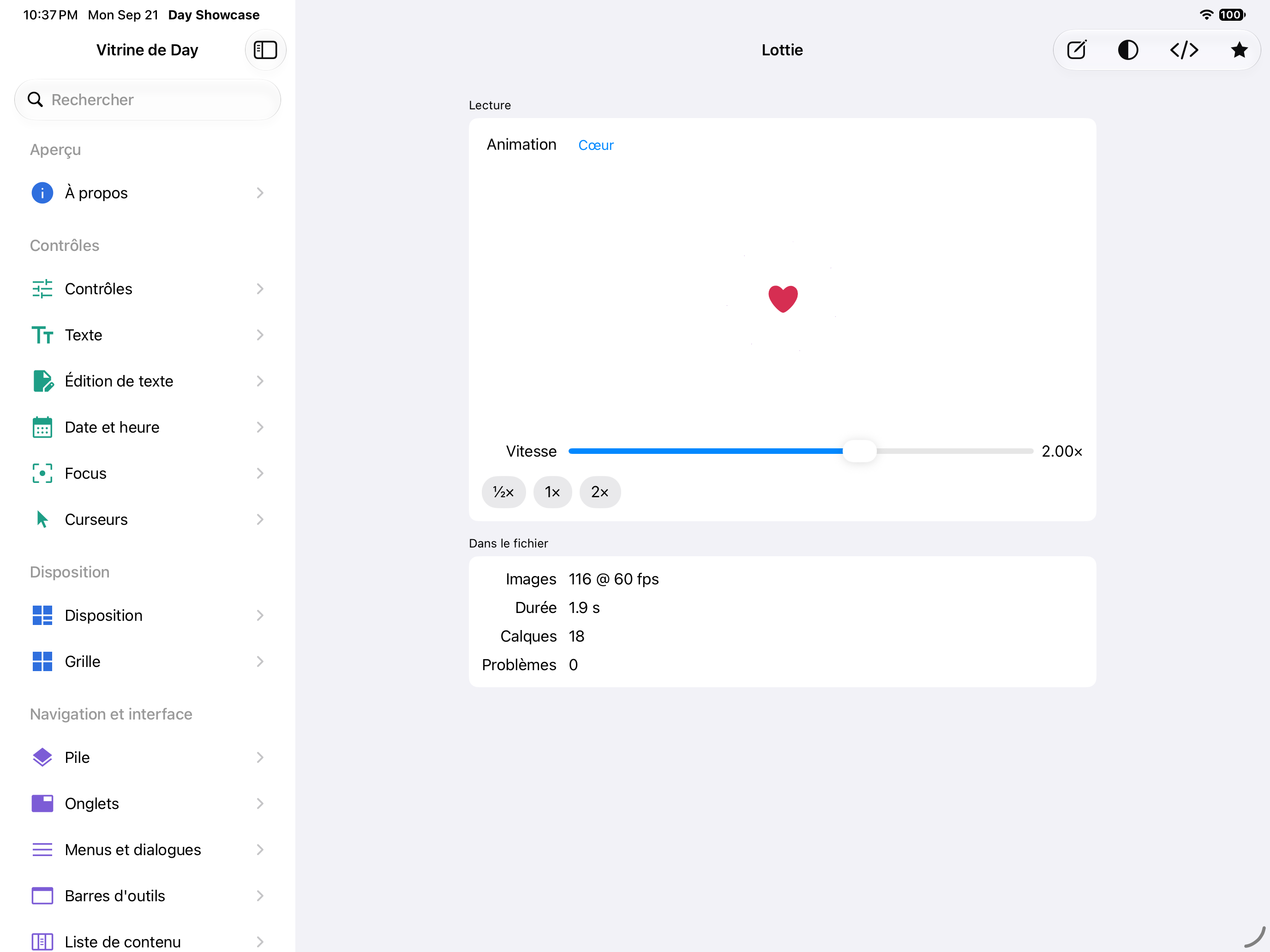Lottie — iOS (UIKit) · iPad