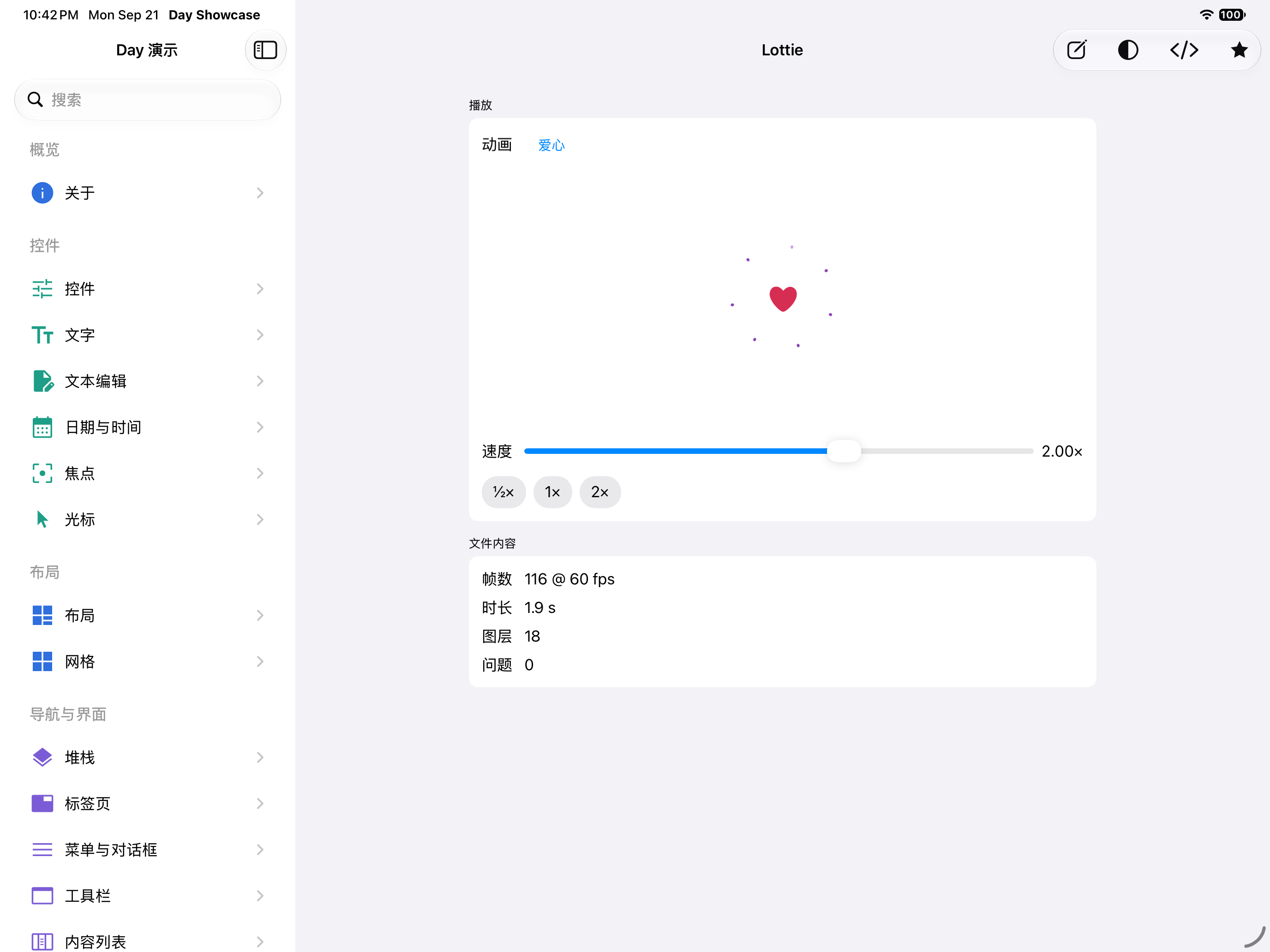 Lottie 动画 — iOS (UIKit) · iPad